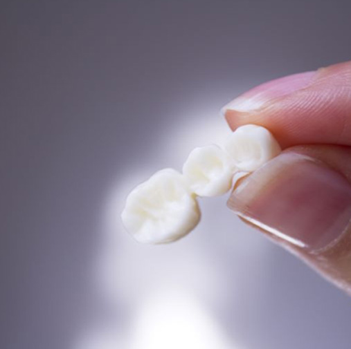 Two fingers carefully holding a dental bridge